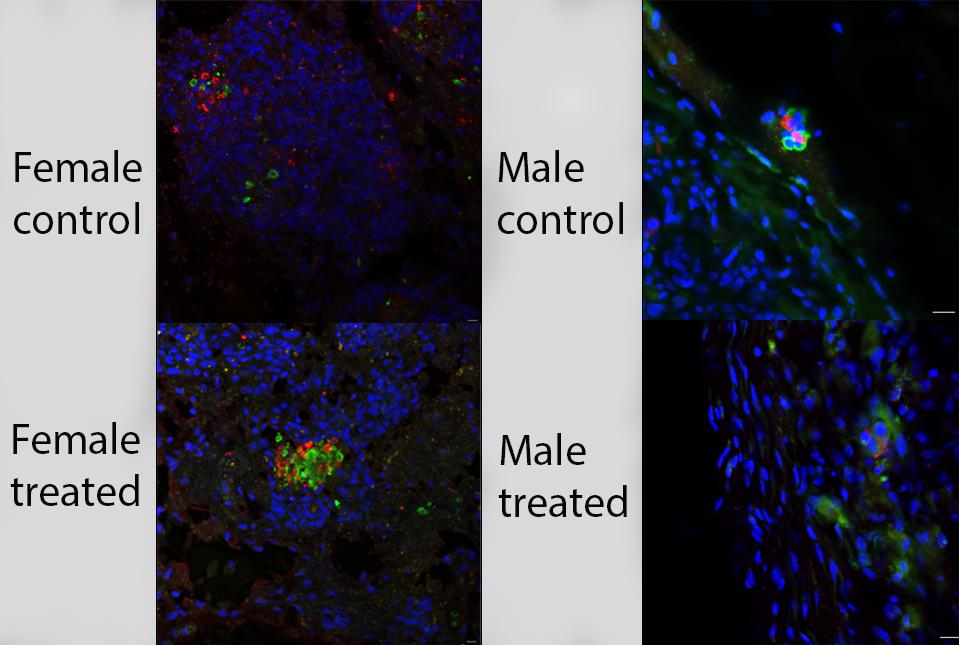 Immunofluorescent image of cells tagged with red, green and blue labels