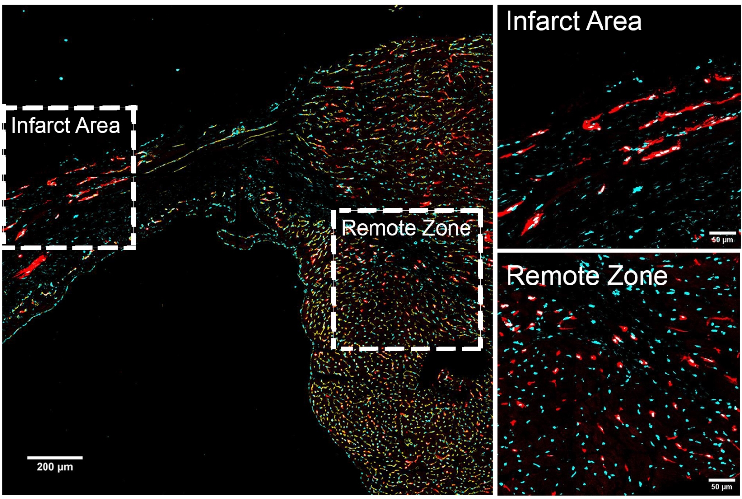 immunofluorescence image of epithelial cells in the mouse heart after infarct