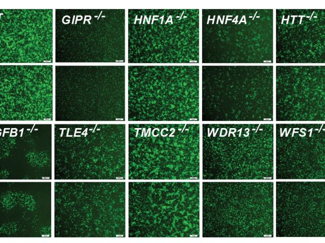 immunofluorescent image of differentiated pancreatic beta cells