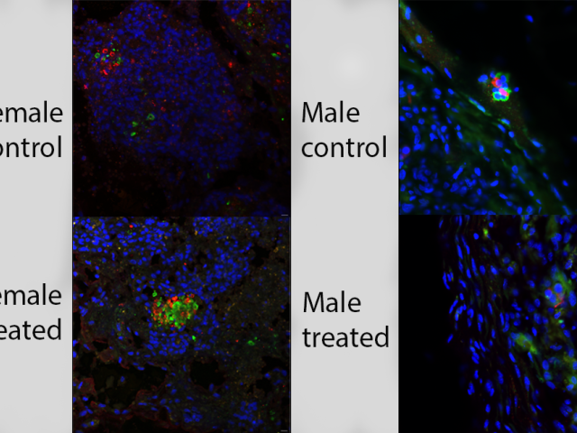 Immunofluorescent image of cells tagged with red, green and blue labels