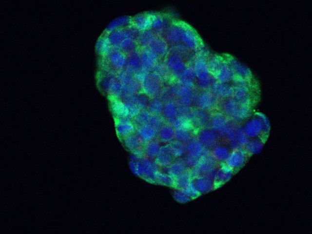 islet cell labeled with green for insulin and blue for nucleus