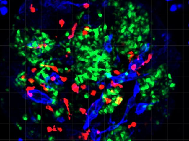 insulin stained green, immune cells stained red, vascular cells stained blue