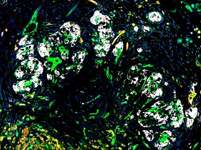 image of islets and blood vessels, both host and grafted